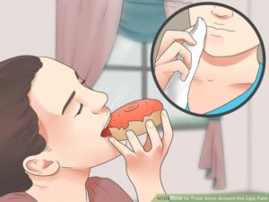 Прыщи на губах после еды