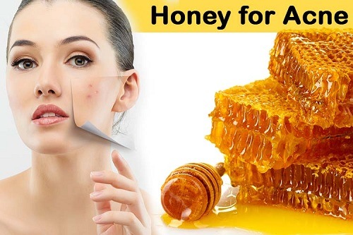 does honey make blind acne go away