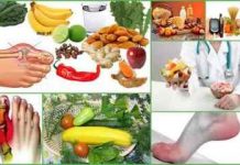 Лечение и профилактика подагры