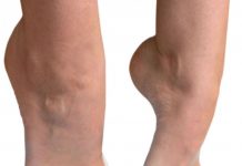 Ортопедические корректоры стопы и пальцев ног