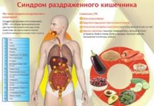 Симптомы синдрома раздраженного кишечника