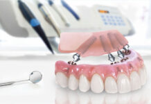 Протезирование зубов: современные методы и технологии в стоматологии