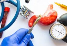 Резекция желудка: эффективный метод лечения ожирения