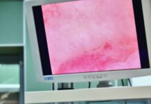 Советы и рекомендации по офисной гистероскопии