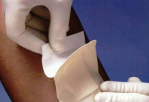 Преимущества применения лейкопластырей в медицинской сфере