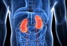 Причины развития почечной колики