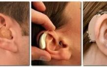 Как выбрать слуховой аппарат: правила подбора