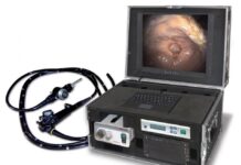 Область применения гастроскопа