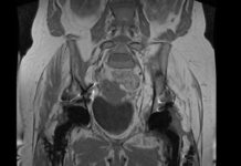 Как проводят МРТ органов малого таза?