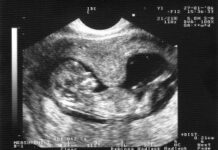 Причины тонуса матки при беременности