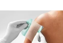 Применение гидроколлоидной повязки