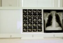 Негатоскоп на четыре рентгеновских снимка: достоинства модели