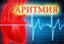 Эффективное лечение аритмии