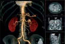 Онлайн-расшифровка КТ