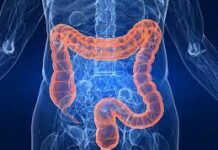 Первые симптомы рака прямой кишки