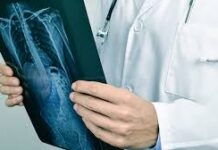 Причины возникновения гемангиомы позвоночника