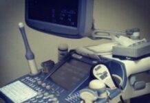 Лучшие современные УЗИ аппараты на 2021 год