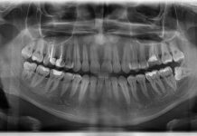 КТ зубов в Пушкино