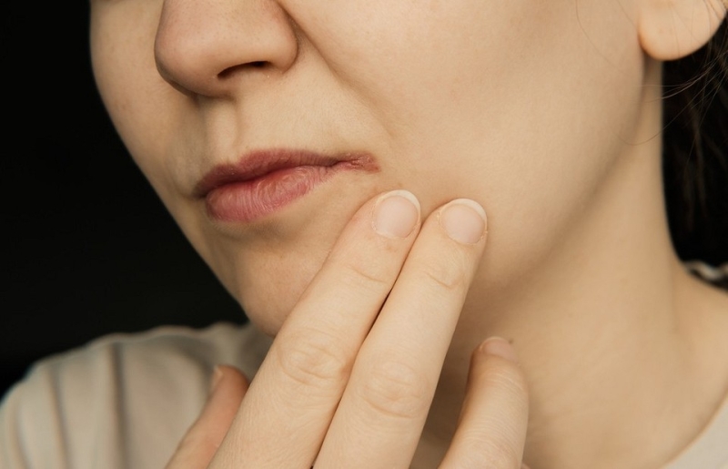 Чем лечить заеды в уголках рта: 4 главных метода и 4 самых полезных средства народной медицины