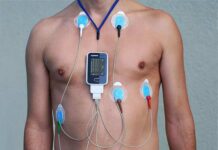 Что такое ЭКГ по Холтеру и в каком случае его назначают