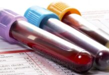 Для чего назначают общий анализ крови?