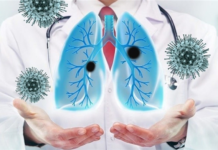 Как проходит реабилитация после COVID-19?