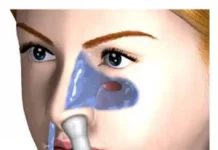 Каковы преимущества и противопоказания промывания носа?