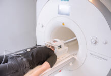 Когда делают МРТ сосудов мозга?