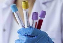 Виды анализов на COVID-19