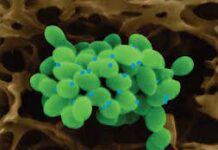 Что такое Букет Венеры и как он лечится?