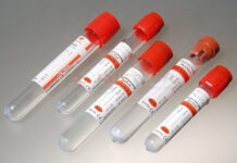 Виды вакуумных систем для педиатрии и их особенности