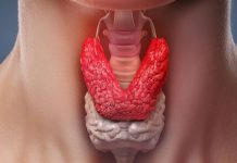 Удаление щитовидной железы